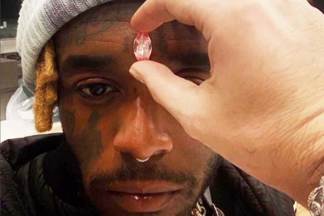 Fans ripped a $24m diamond from Lil Uzi Vert’s forehead, according to the rapper