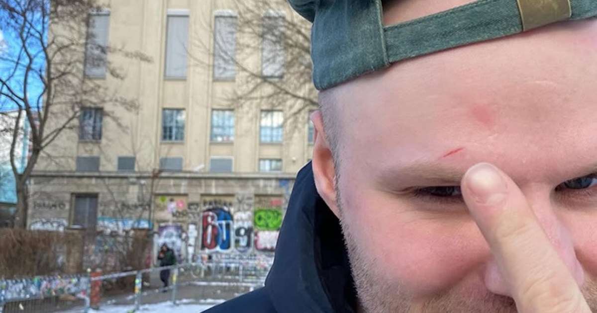 ​Kasper Marott faints onto mixer during Berghain DJ set: “I caused quite a scene”