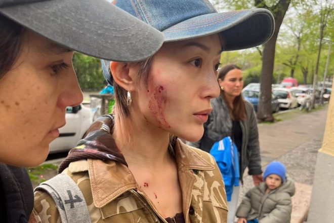 Kim Ann Foxman and Cora assaulted in suspected hate crime