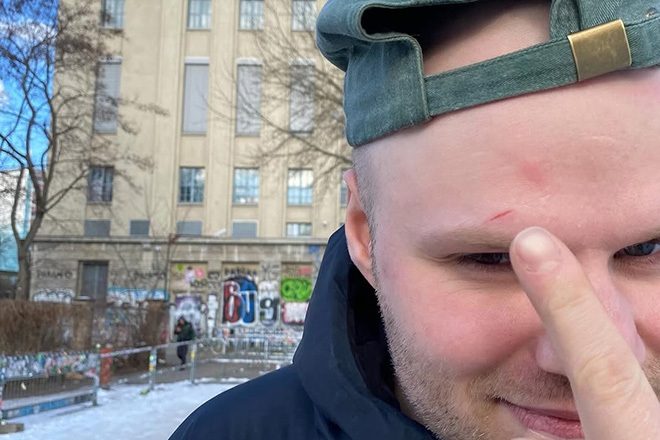 ​Kasper Marott faints onto mixer during Berghain DJ set: “I caused quite a scene”